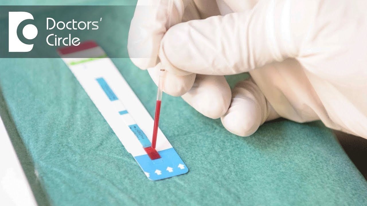 4Th Generation Hiv Test Accuracy 4 Weeks