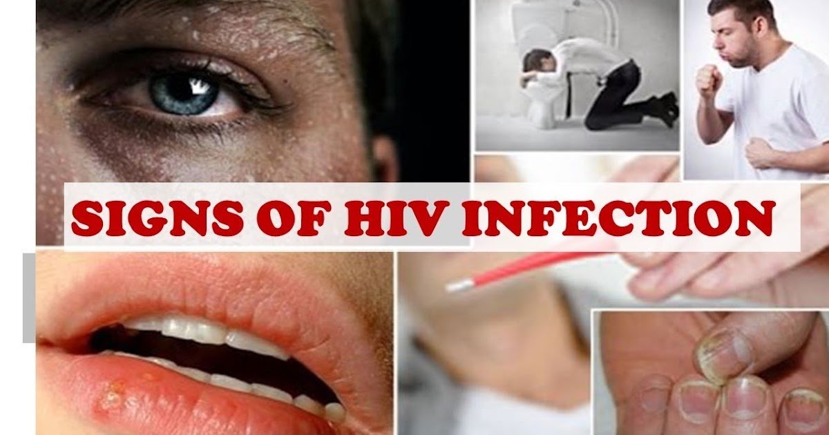 5 Common HIV Symptoms in Men â Ladies, See How To Know If ...