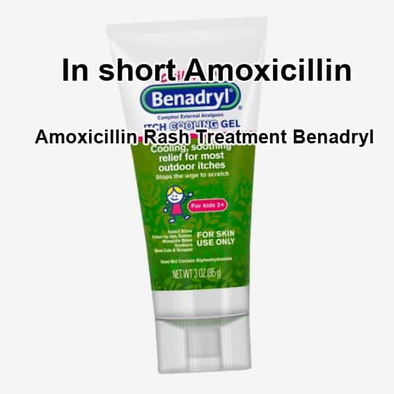 Amoxicillin rash treatment benadryl, amoxicillin rash treatment ...