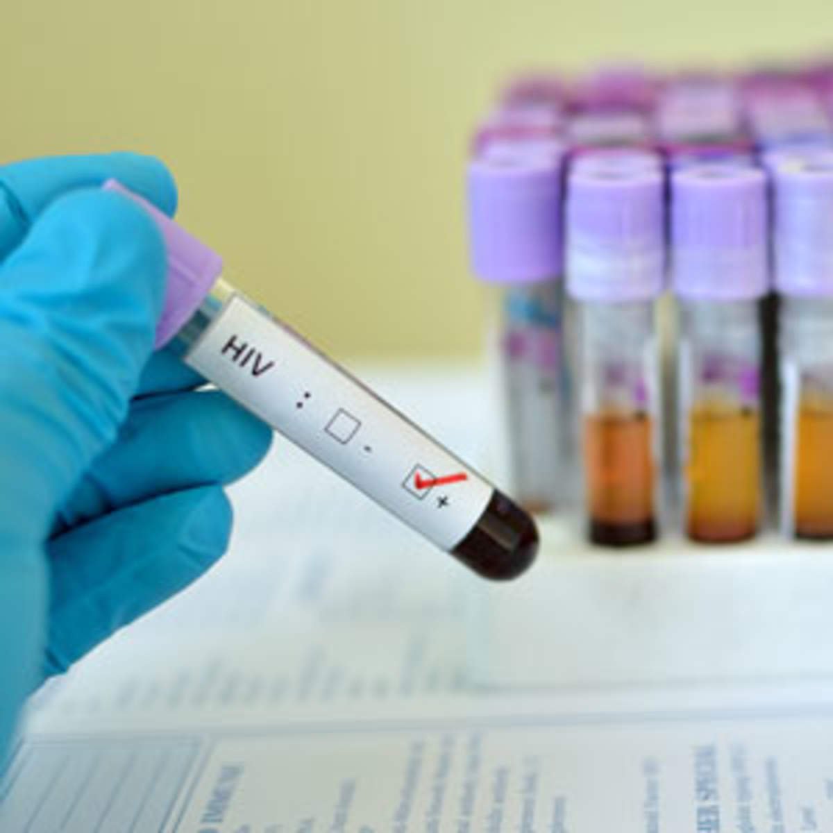 Can a Regular Blood Test Detect HIV?