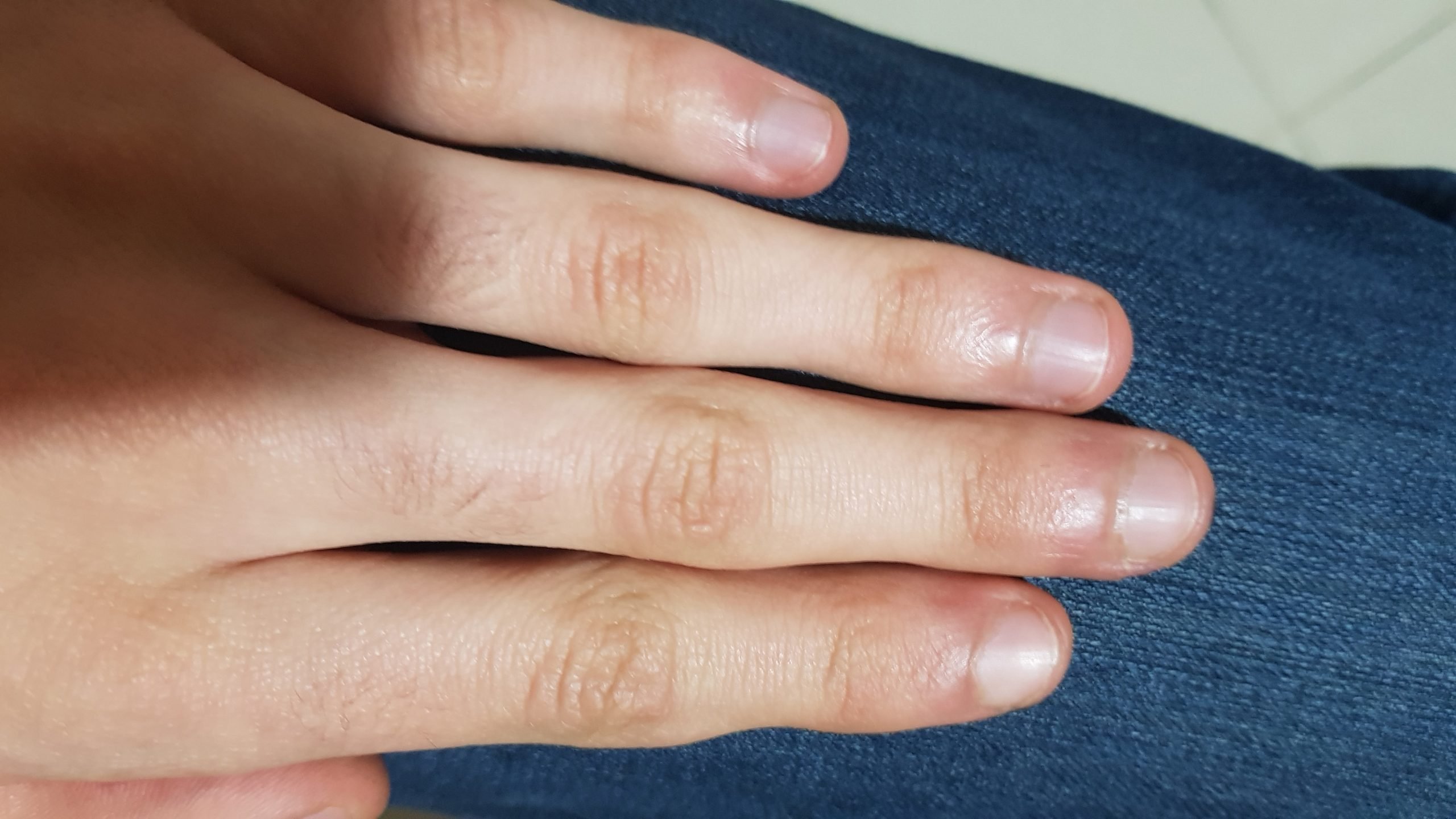 Can I get HIV from rectal fingering if I bite my cuticles?