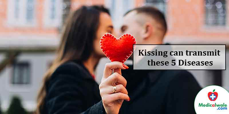 Can Kissing Transmit Hiv / Megan Andelloux