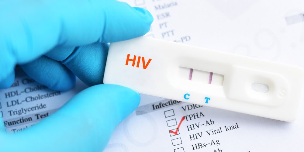 Can you die from HIV?