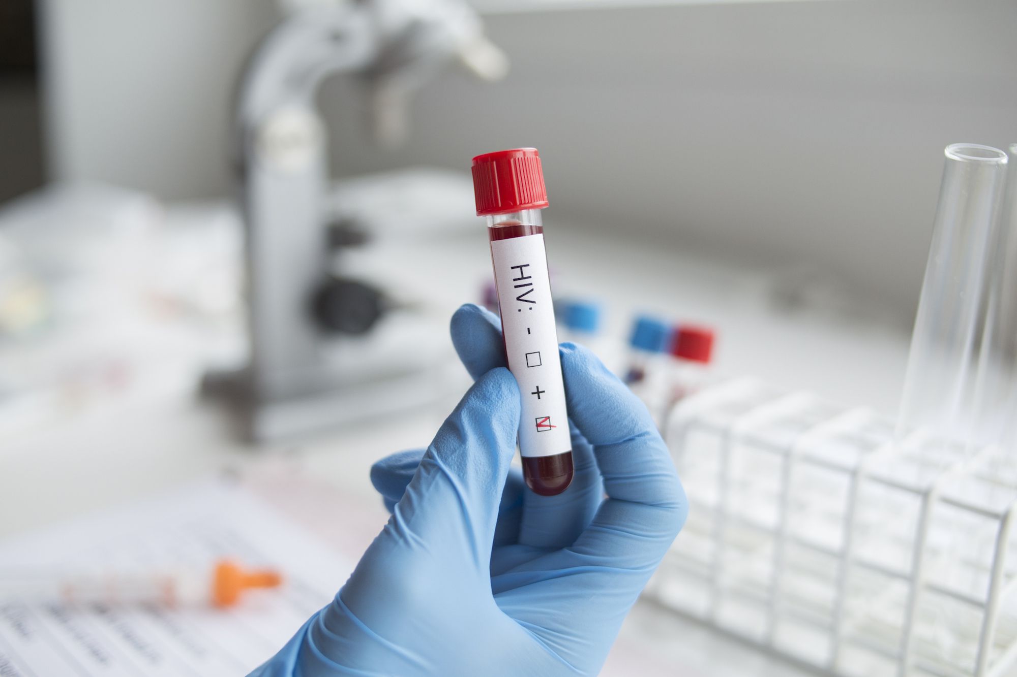 Deciphering Routine HIV Blood Tests