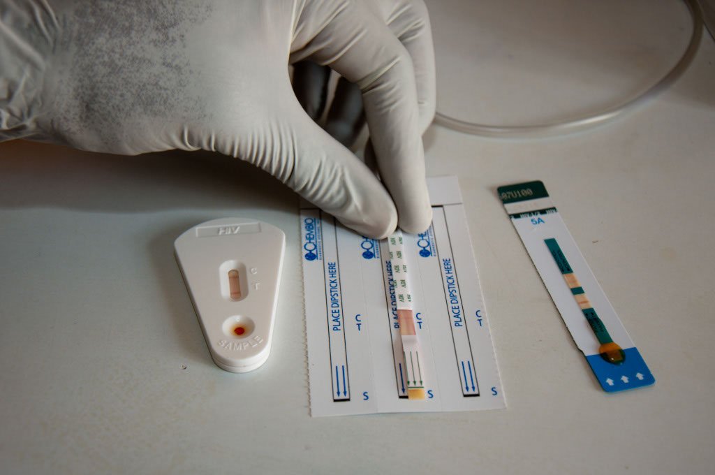 Defective HIV test kits a big concern