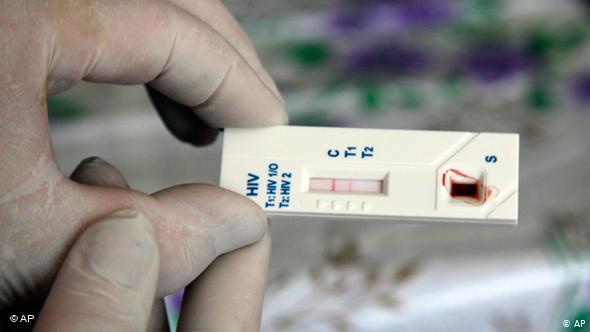 Faster results for HIV tests in Germany
