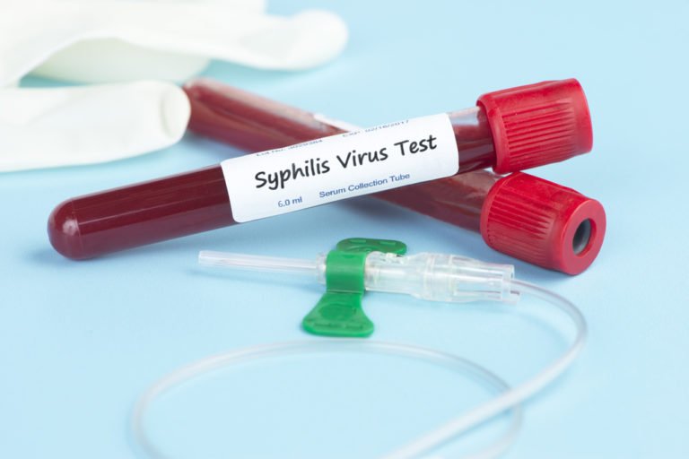 Free Syphilis Testing