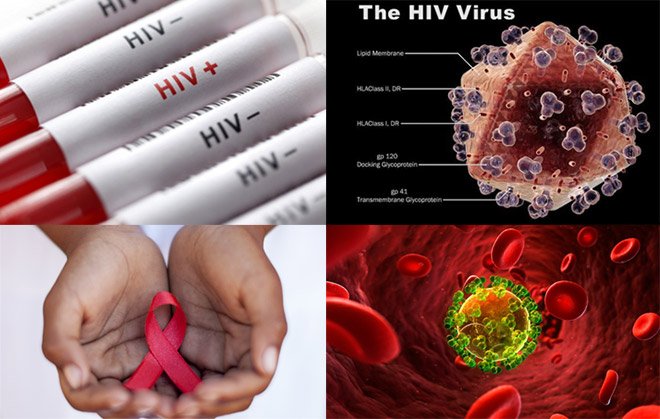 Get rid of HIV/AIDS stigma