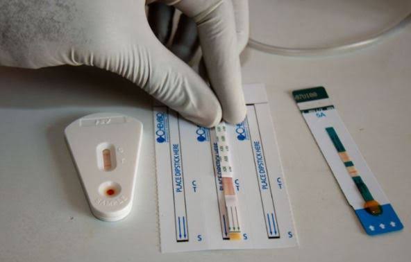 Govt. launch HIV rapid test kit  Ayekooto