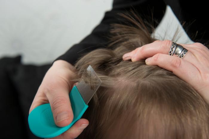 Head lice: Causes, symptoms, and treatments