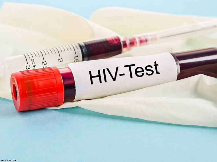 HIV 101: Is It Possible I Got a False Positive on My HIV Test?