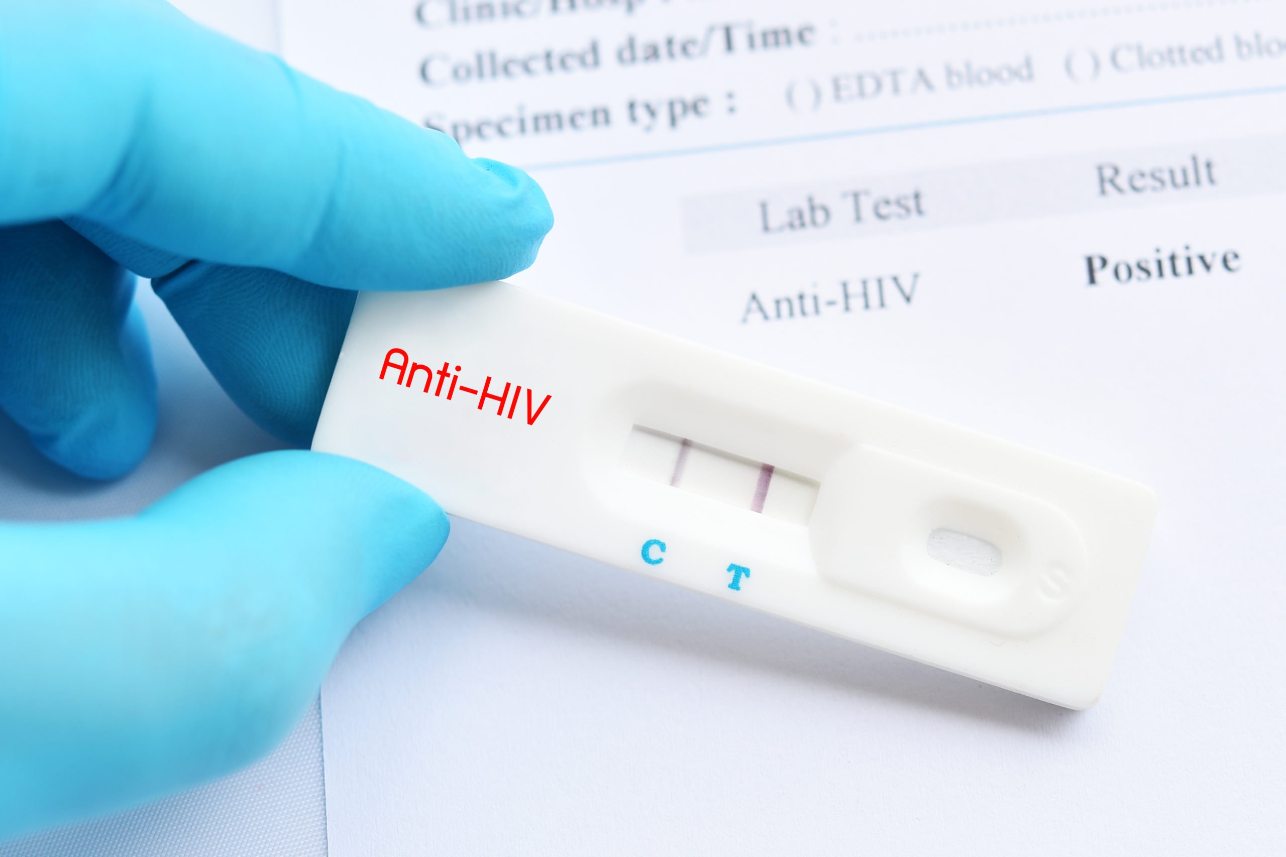 HIV  a challenging disease to diagnose