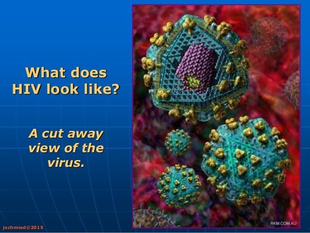 Hiv aids presentation