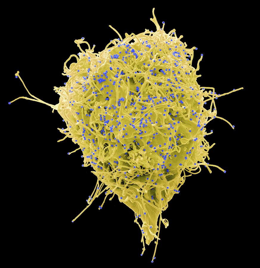Hiv Infected Cell Photograph by Steve Gschmeissner/science ...