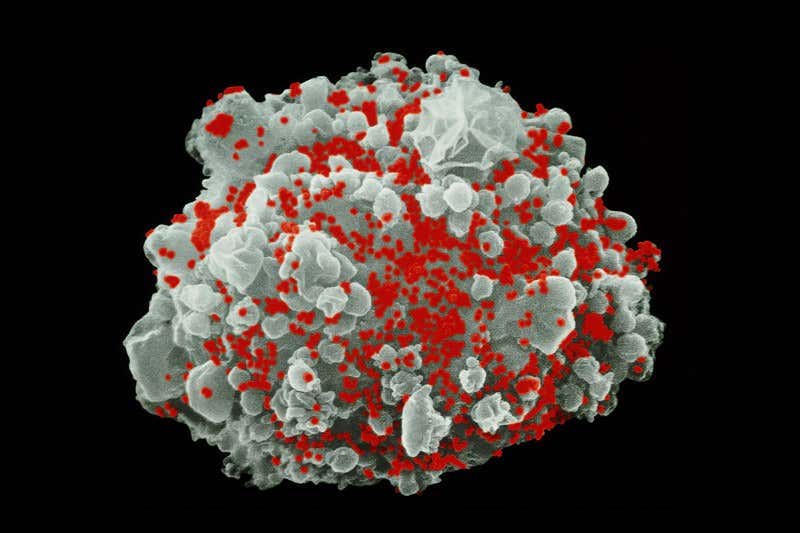 HIV may kill most cells by a method overlooked for years ...