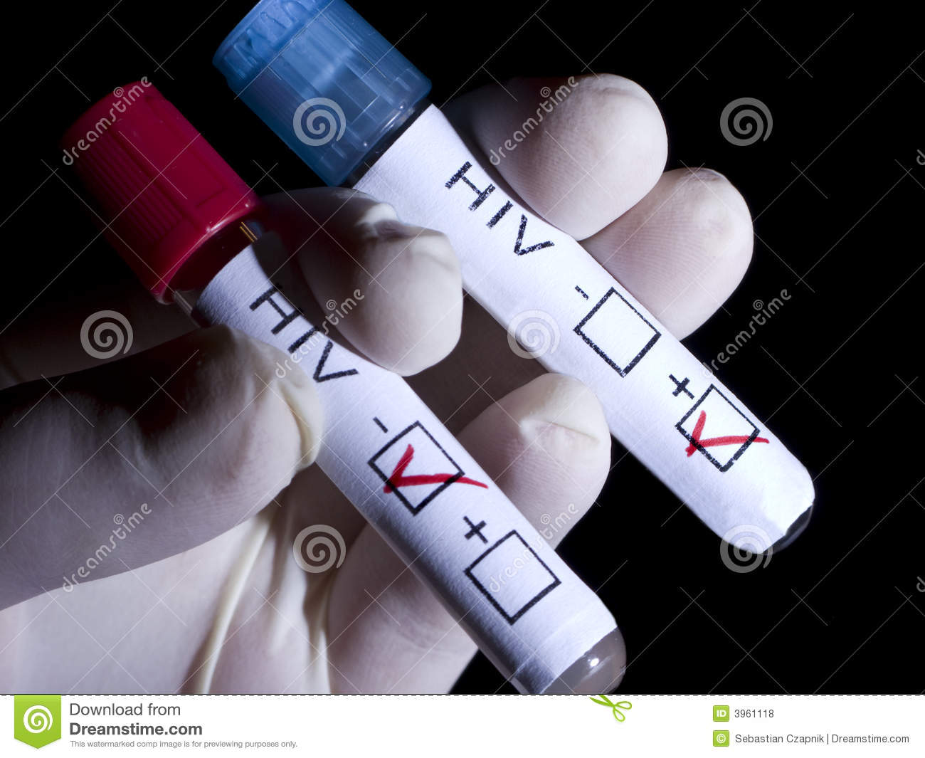 HIV Positive And Negative Royalty Free Stock Photos ...