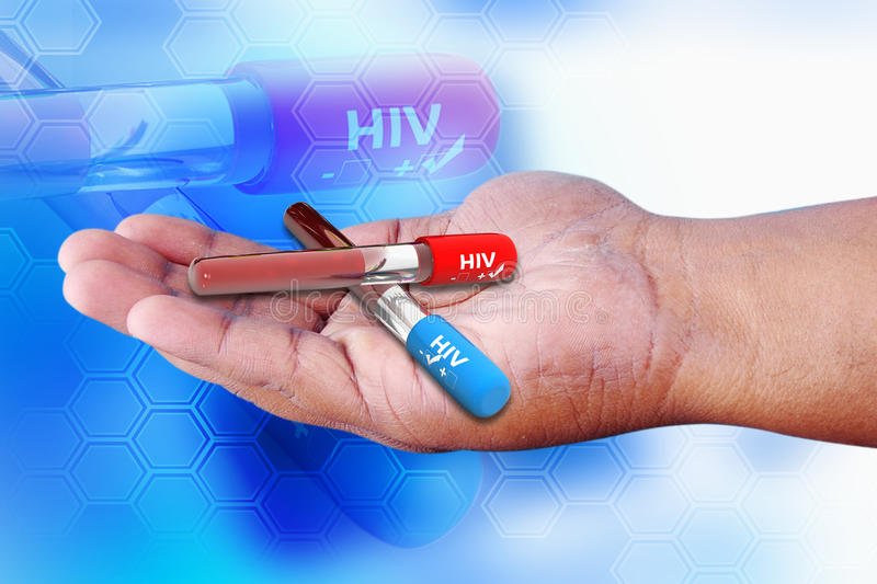 HIV positive and negative stock photo. Image of celibacy ...