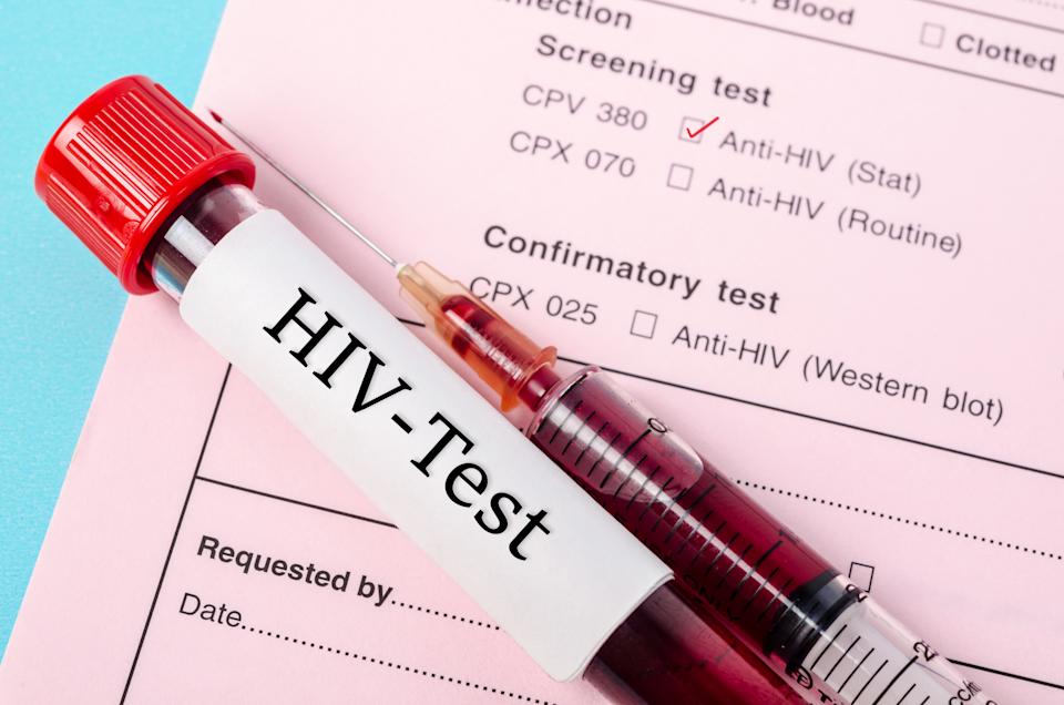 HIV: second patient 