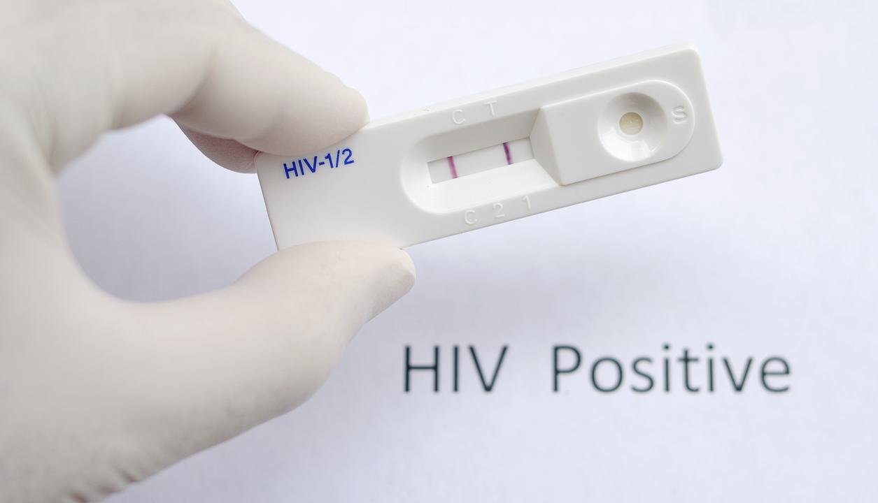 HIV Test Online