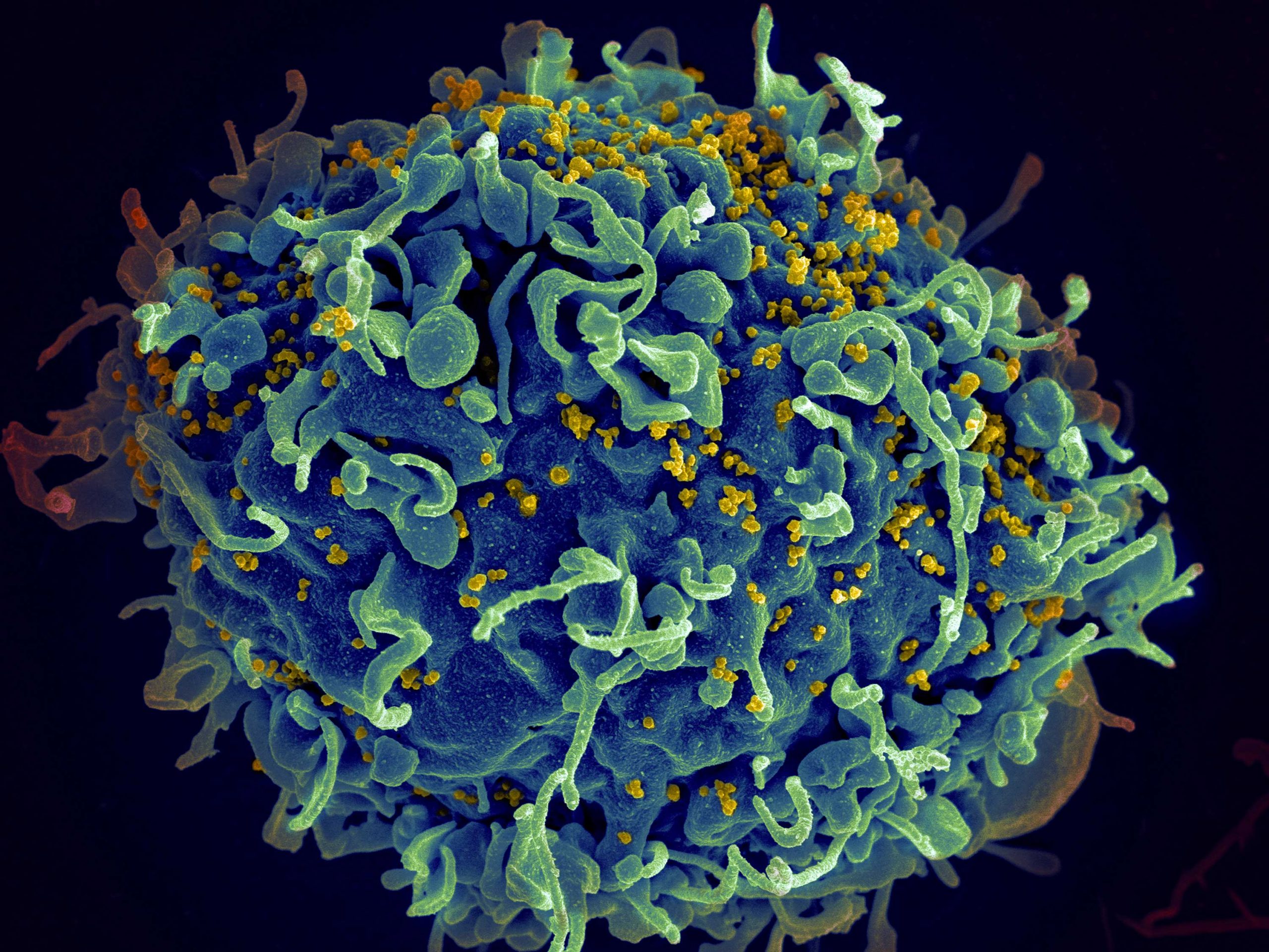 HIV virus in disguise tricks immune system