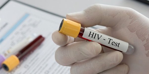 How do HIV test kits work?