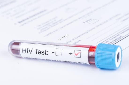 How Long Should You Wait To Take An Hiv Test?  ucsf