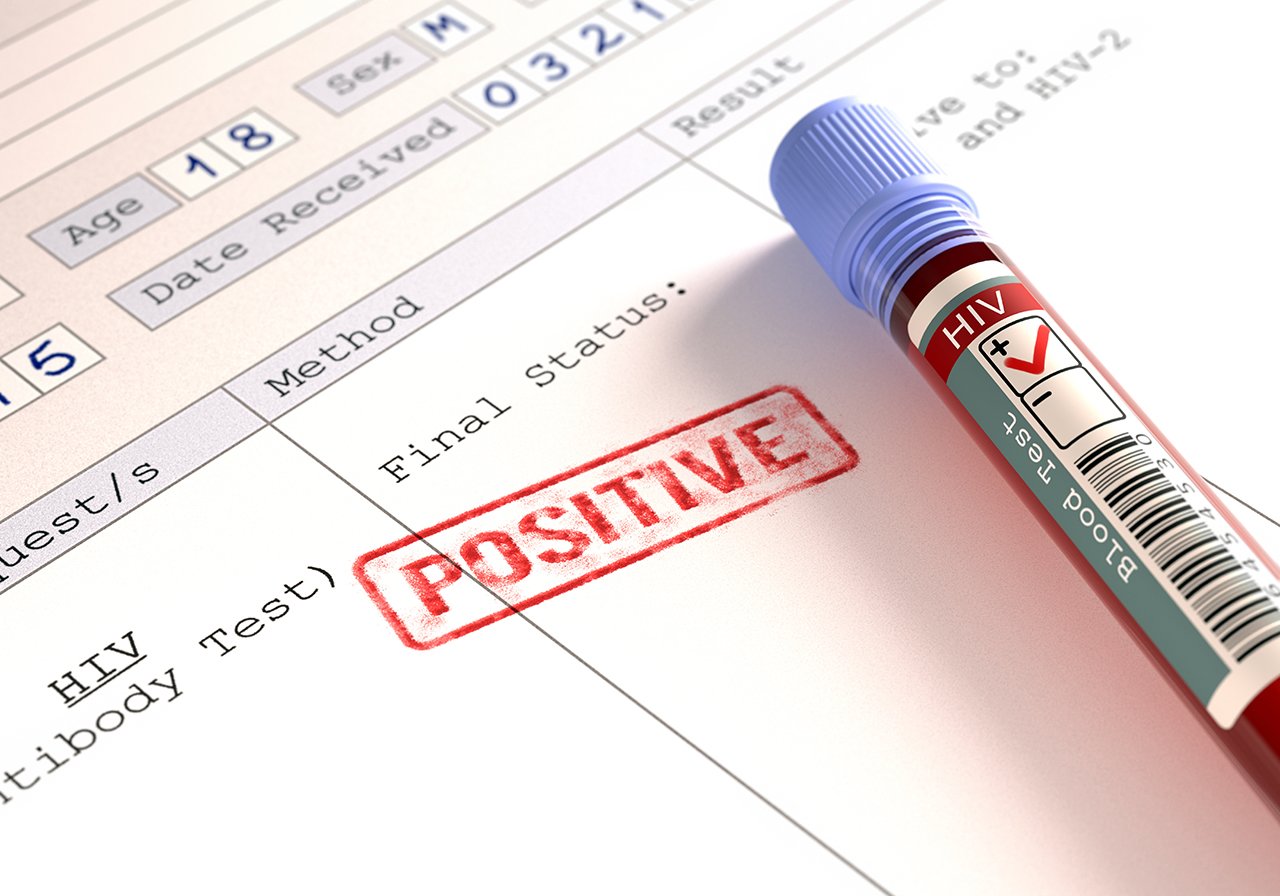 How To Live Longer After Getting A False Positive HIV Test