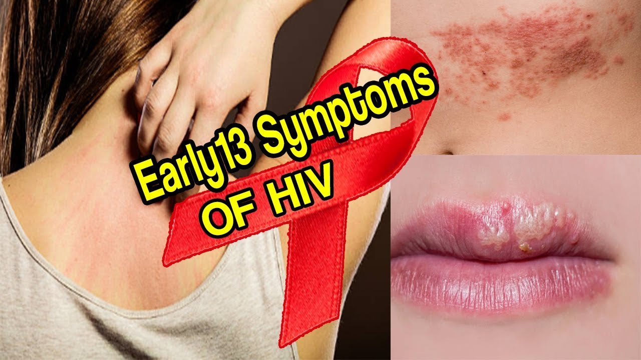 If You See These 13 Symptoms, Do An HIV Test Immediately ...