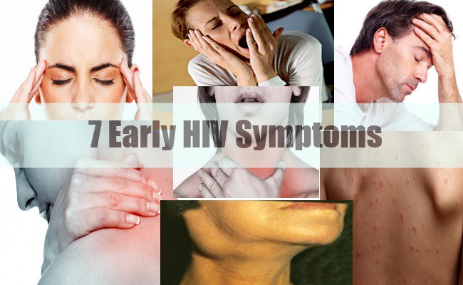 If You See These Symptoms, go for an HIV Test Immediately ...