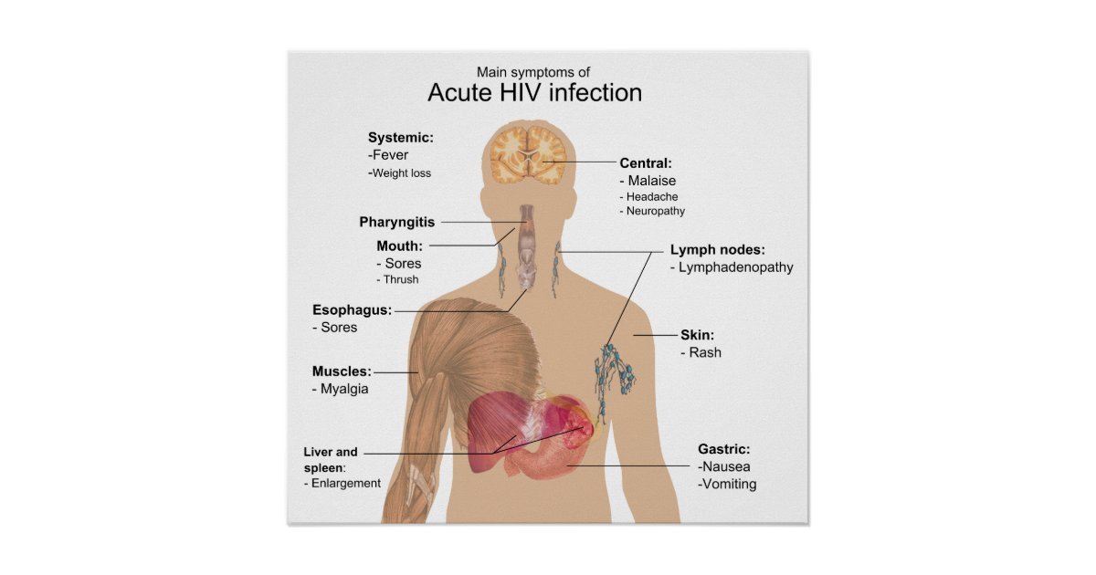 Main Symptoms of Acute HIV Infection Poster