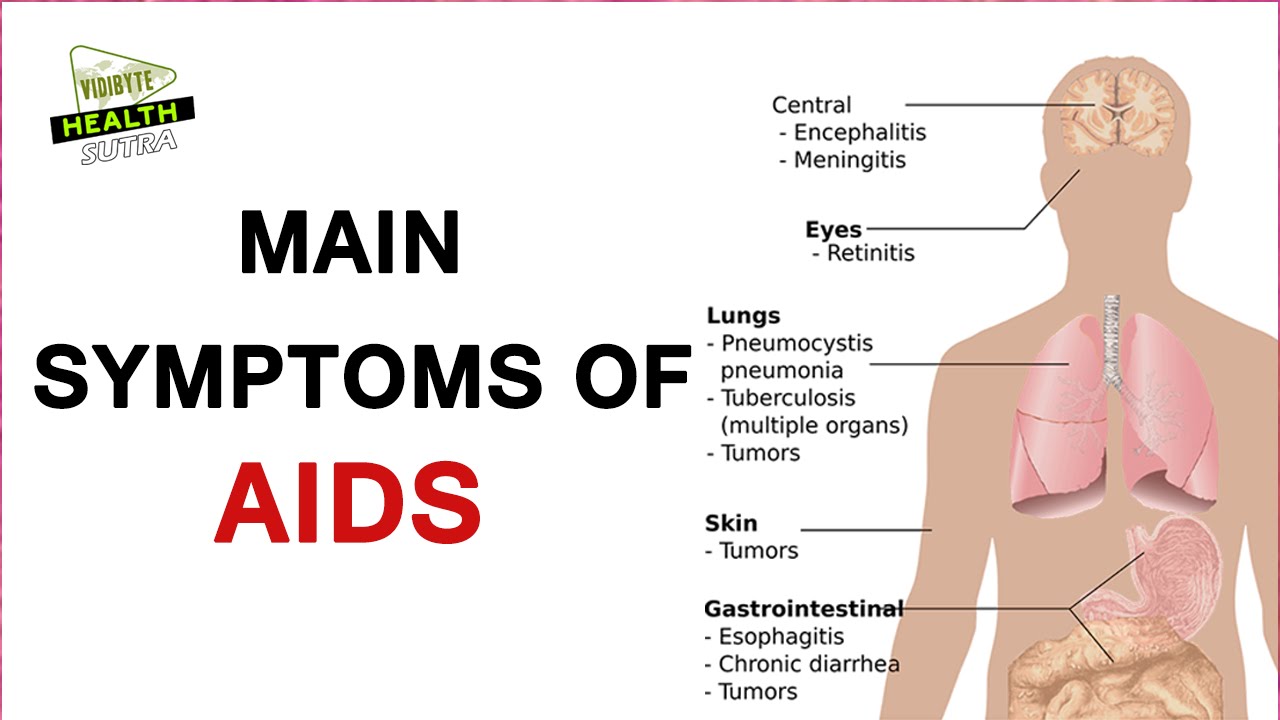 Main Symptoms of HIV or AIDS ?