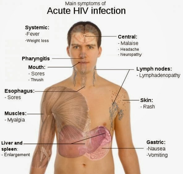 ONE OF HIV SYMPTOMS IS RASH â Majestic Glow Collection ...