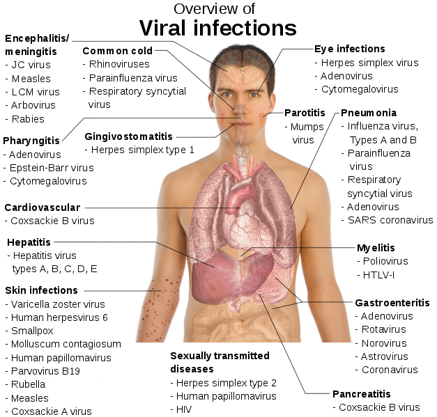 Overview of viral infections