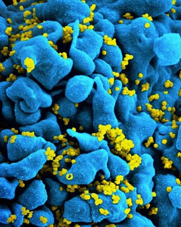 Physical Origin Of HIV Virus Found In Africa