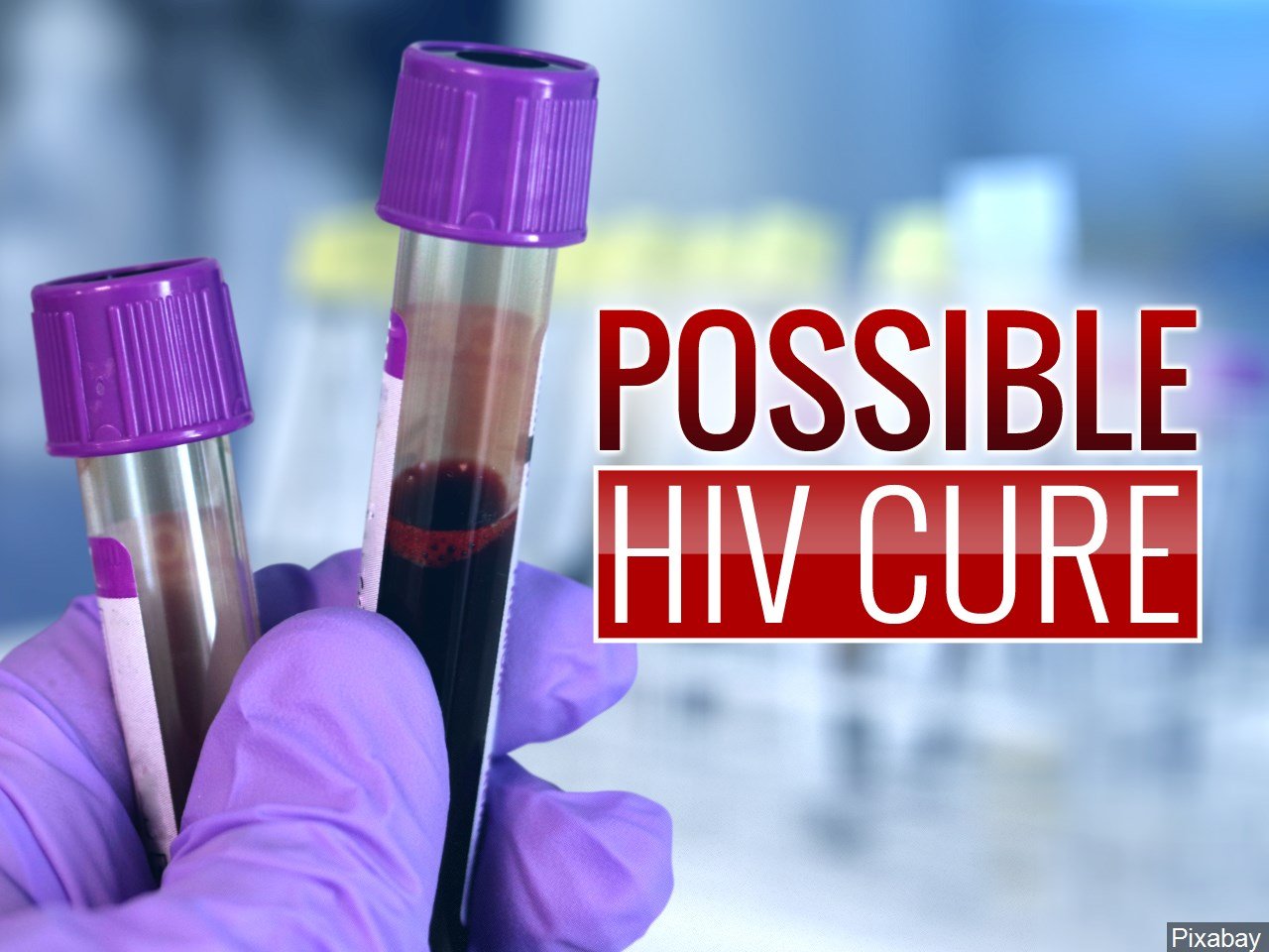Possible HIV Cure, Study Eliminates Virus in Mice  NBC ...