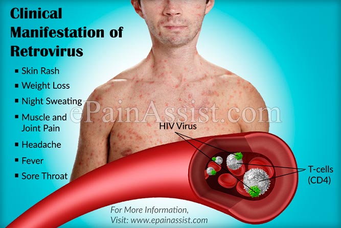 Retrovirus or HIV Infection
