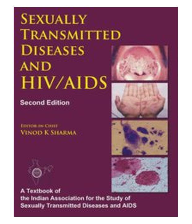 Sexually Transmitted Diseases And Hiv/Aids, 2/E: Buy Sexually ...