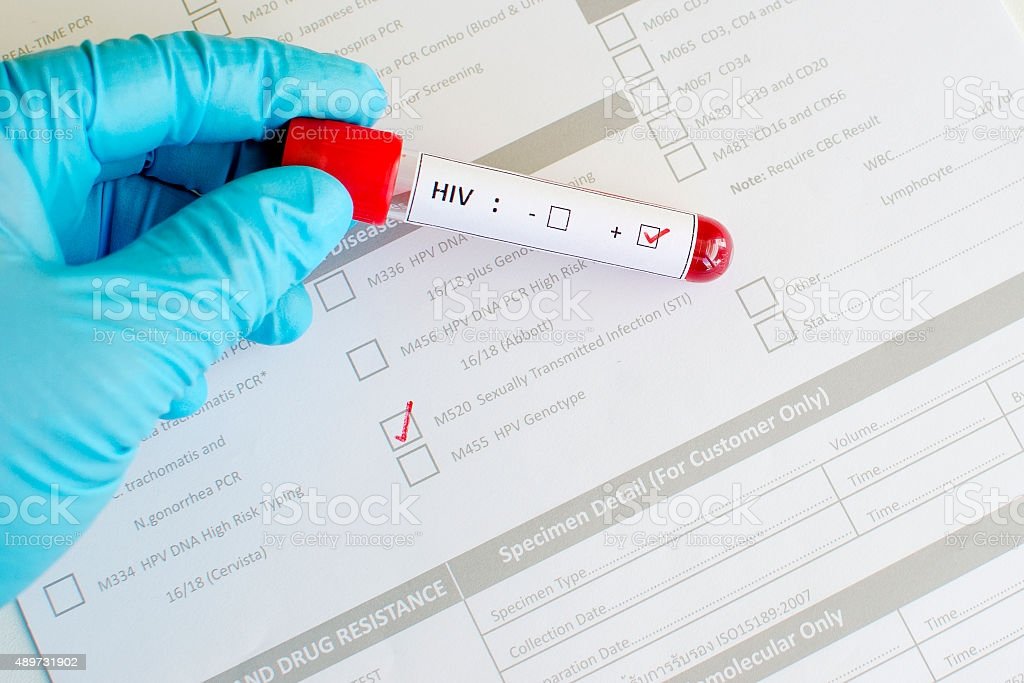 Sexually Transmitted Diseases Hiv Stock Photo