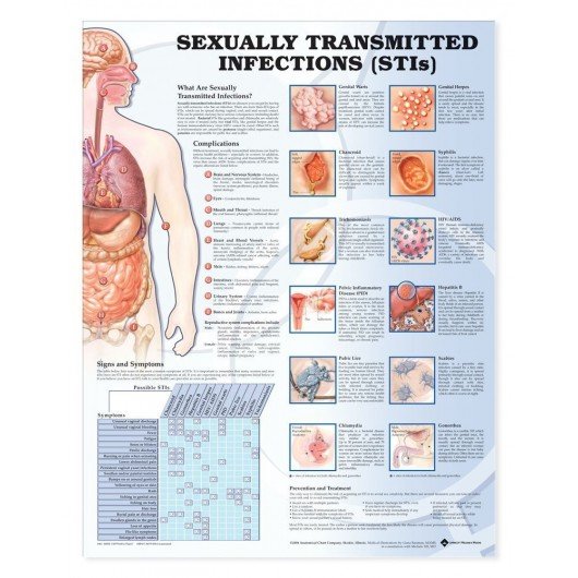 Sexually Transmitted Infections (STIs) Anatomical Chart
