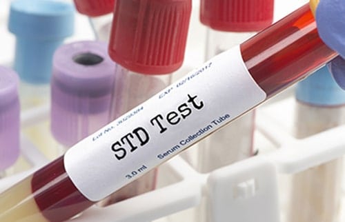 STD test and HIV prevention