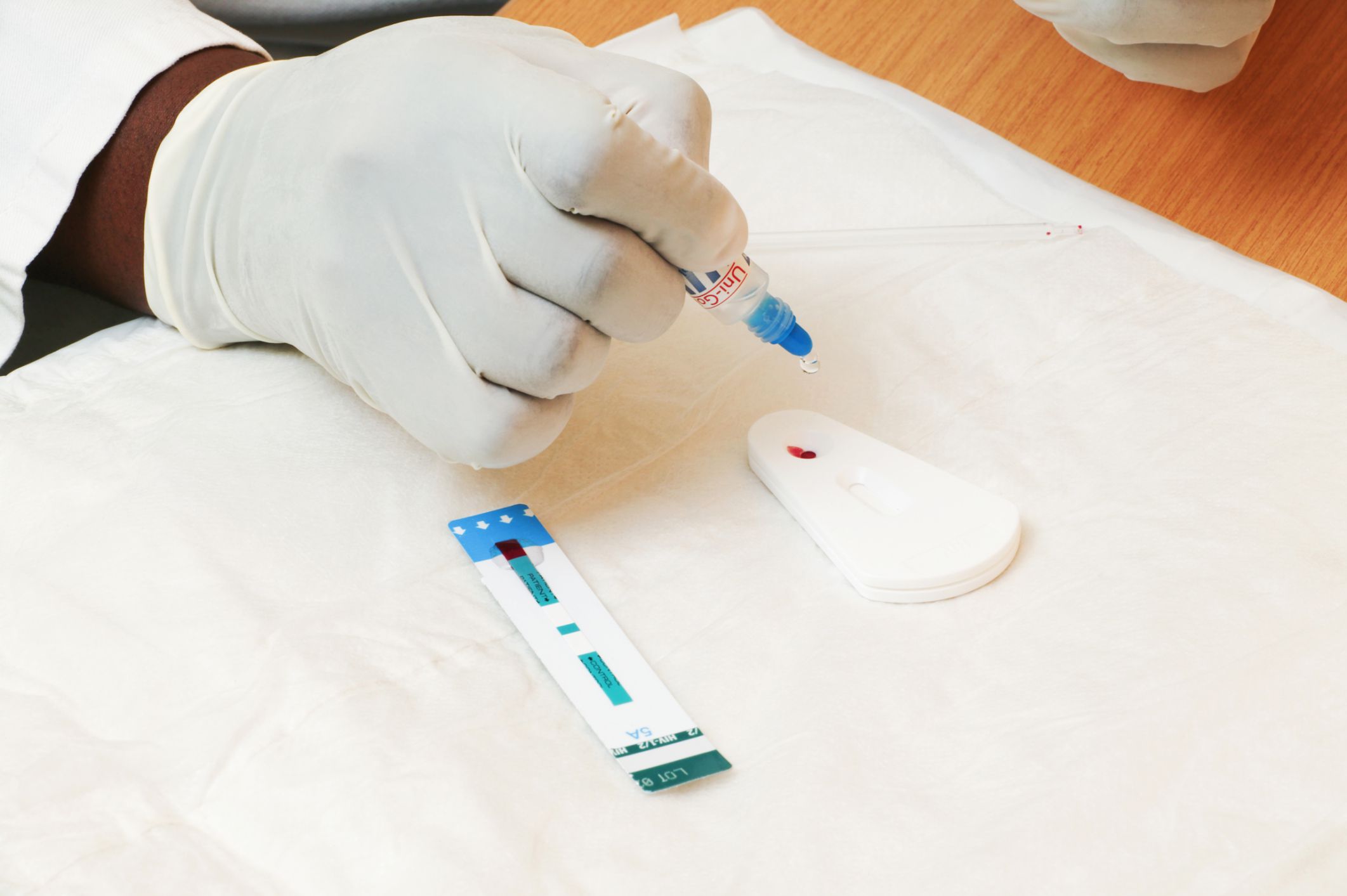 What Does a Negative HIV Test Result Mean?